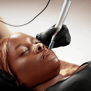 Lumen Clarity Series at Face Space Esthetics in Fayetteville, NC